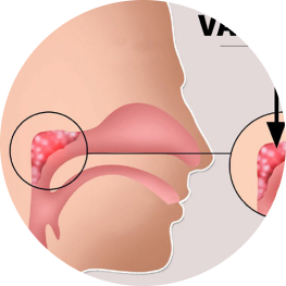 Những lời khuyên khi bị khàn tiếng